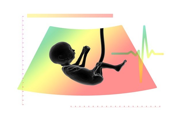 baby heart rate