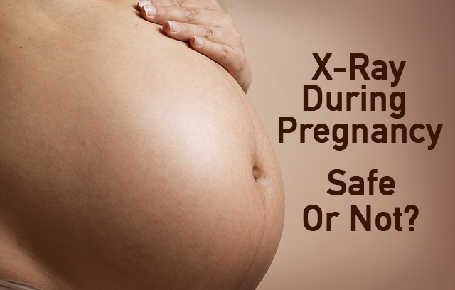 x-ray pregnancy
