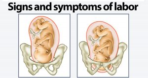 labor symptoms