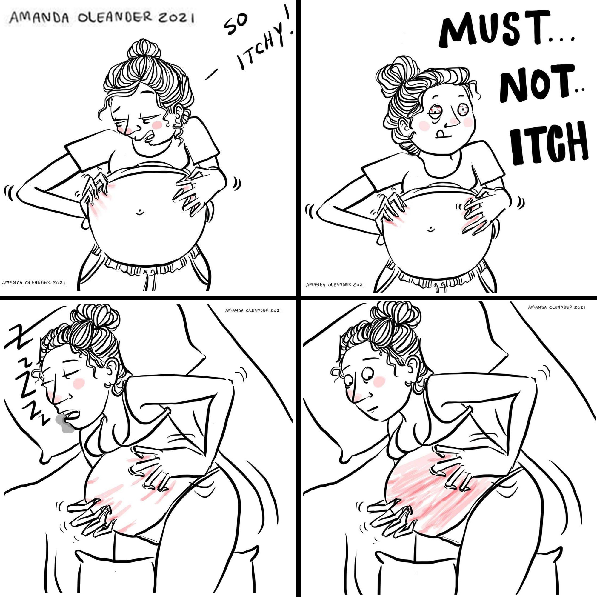 must not itch pregnancy
