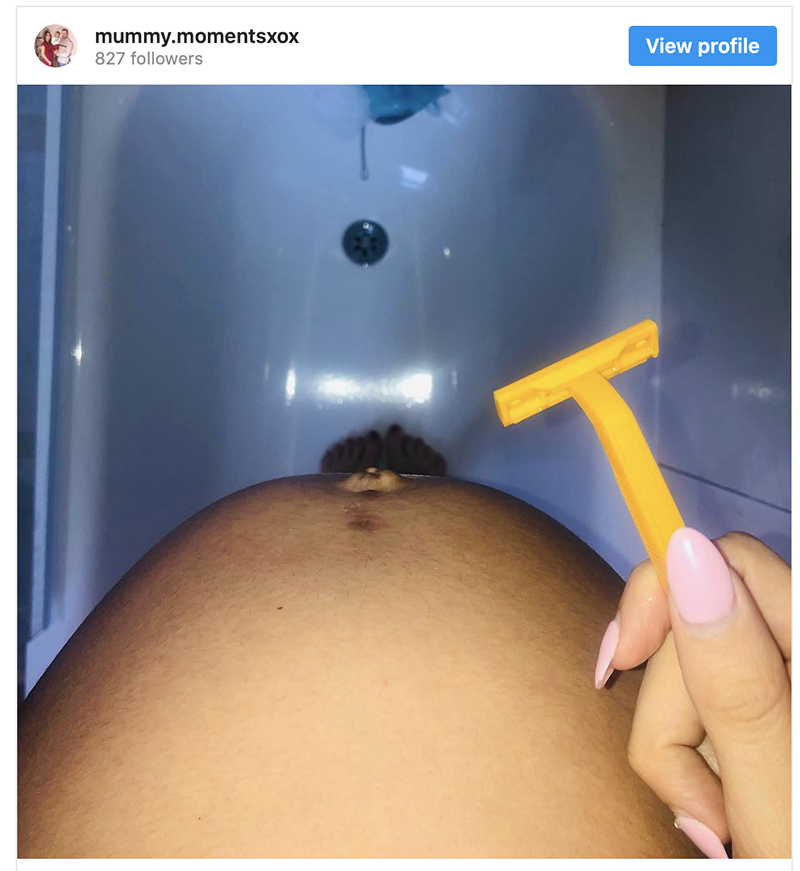 pregnant can't shave